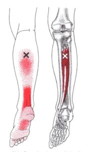 Tibialis Posterior