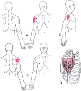 Shoulder Pain - Massage Therapy Connections