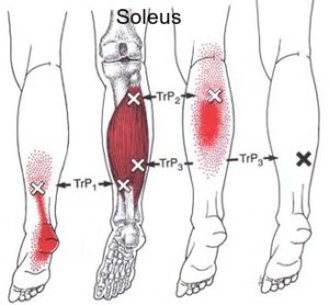 Leg Pain - Massage Therapy Connections