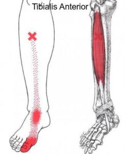 Leg Pain - Massage Therapy Connections