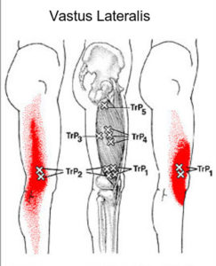 Leg Pain - Massage Therapy Connections